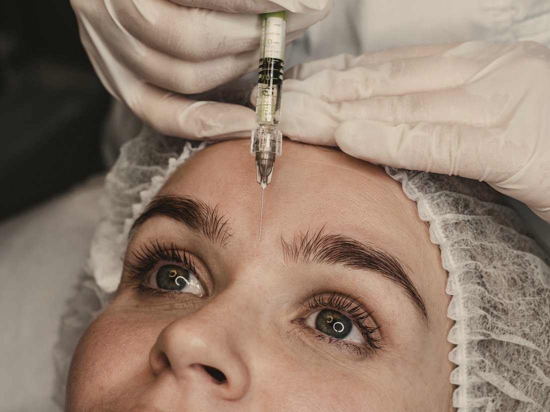 Aplicação de toxina botulínica